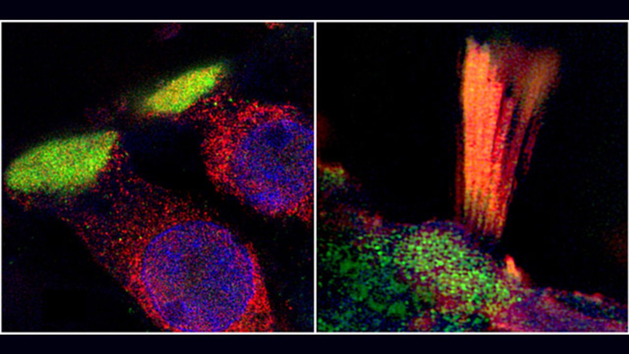 Hearing Loss Genes Imaged in New Study
