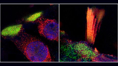 Hearing Loss Genes Imaged in New Study
