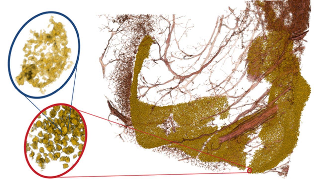 3D X-Rays Reveal the Neuronal Impact of Alzheimer's