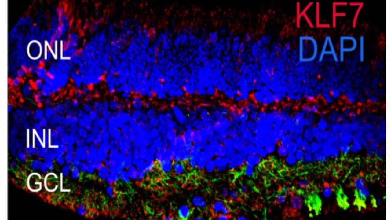 First Single-Cell Atlas of the Human Eye Constructed