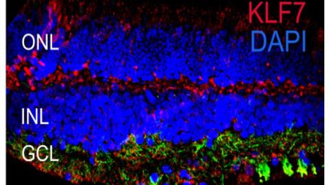 First Single-Cell Atlas of the Human Eye Constructed