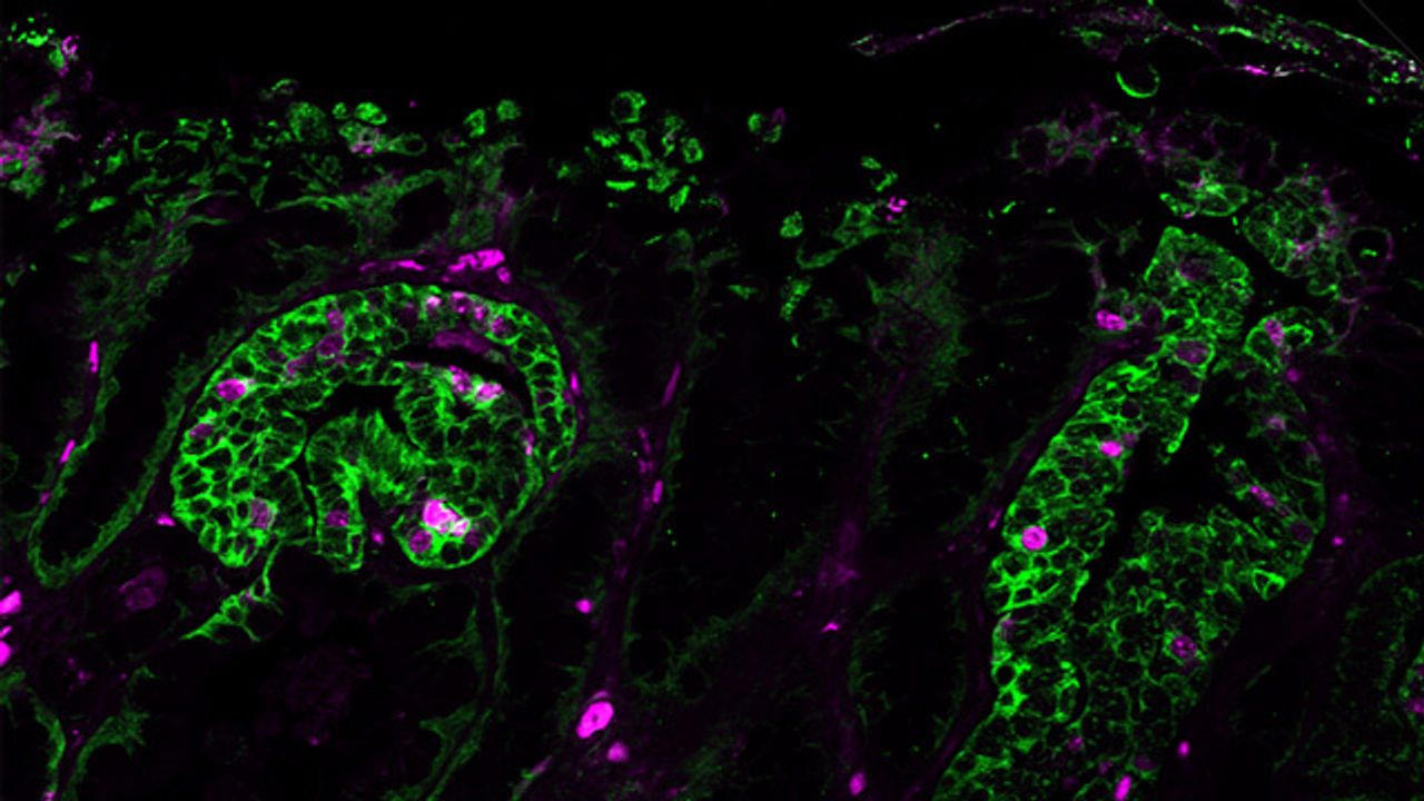 New Preclinical Models Help To Identify Drivers of Gastric Cancer Growth