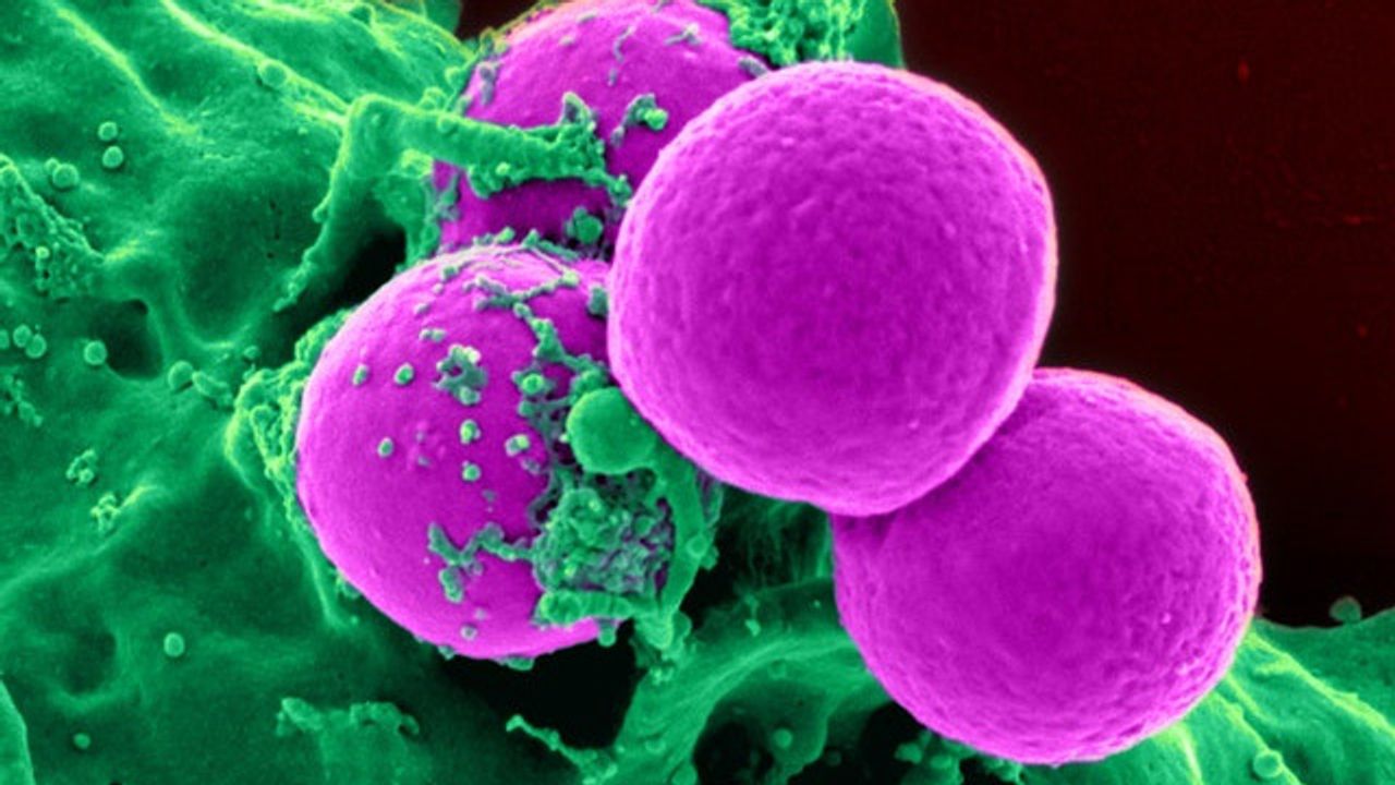 How Bacterial Pathogens Cope With Starvation