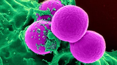 How Bacterial Pathogens Cope With Starvation