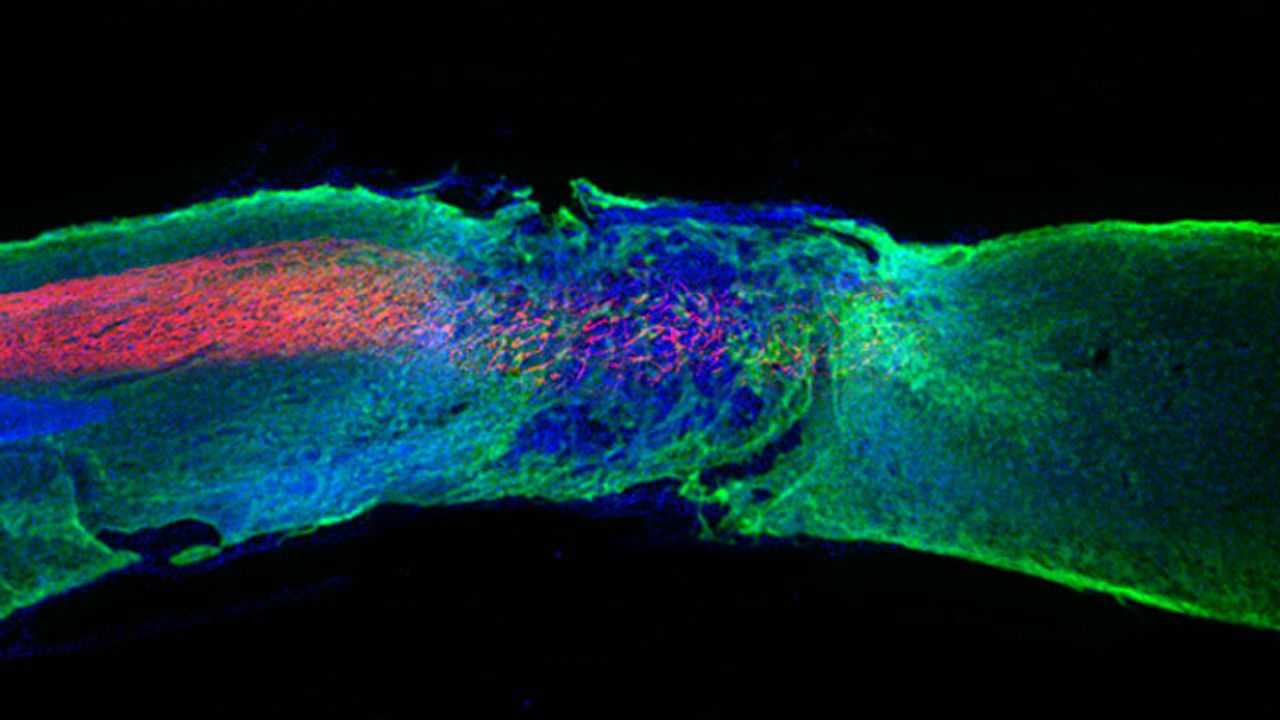 Spinal Cord Section