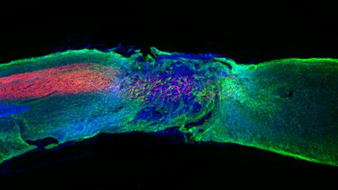 Spinal Cord Section