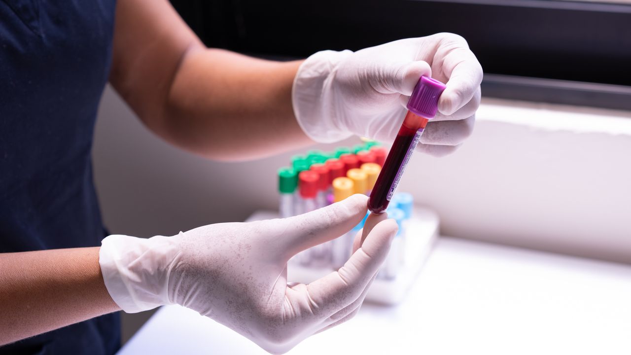 Changing the Future of Multiplexing