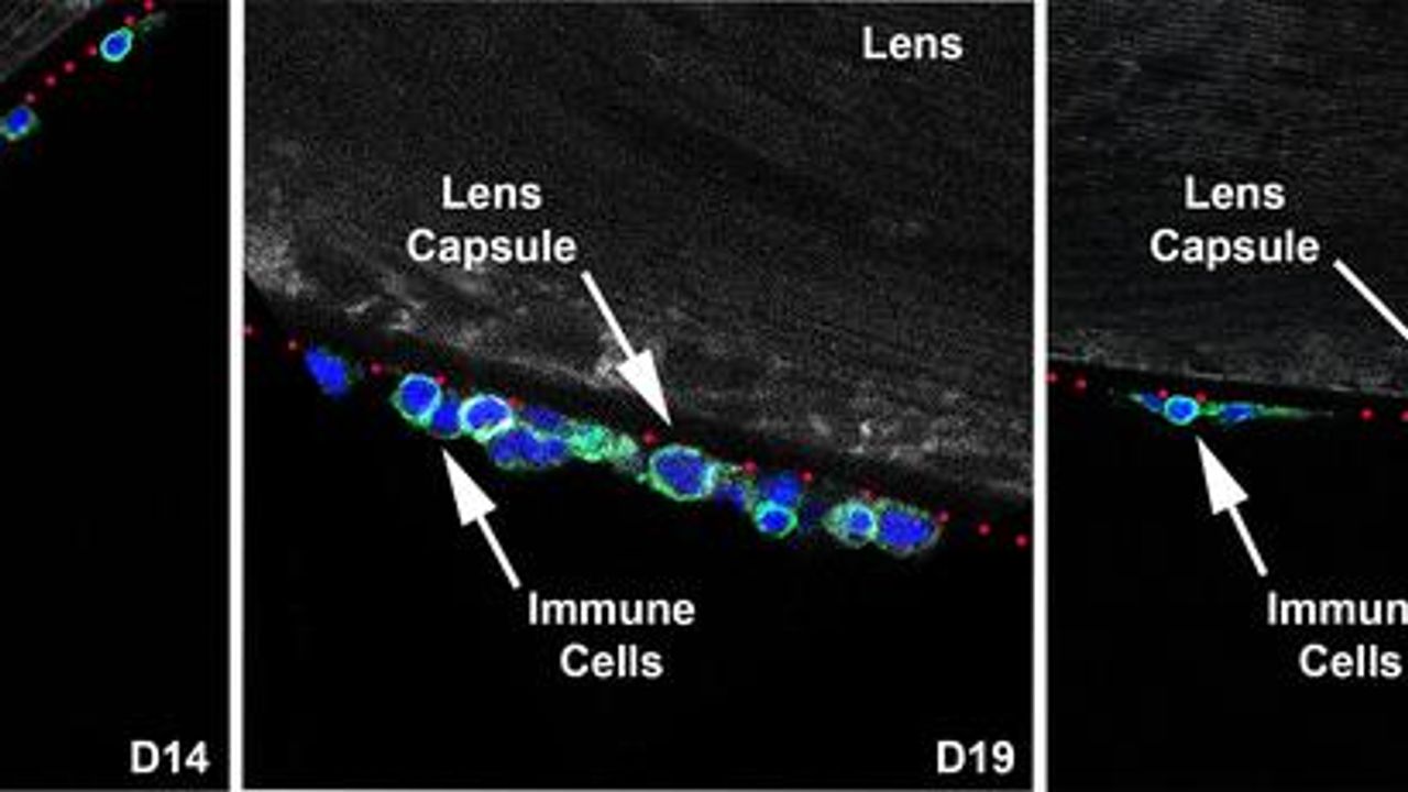 Long-Held Belief on Eye Immunity Turned on Its Head