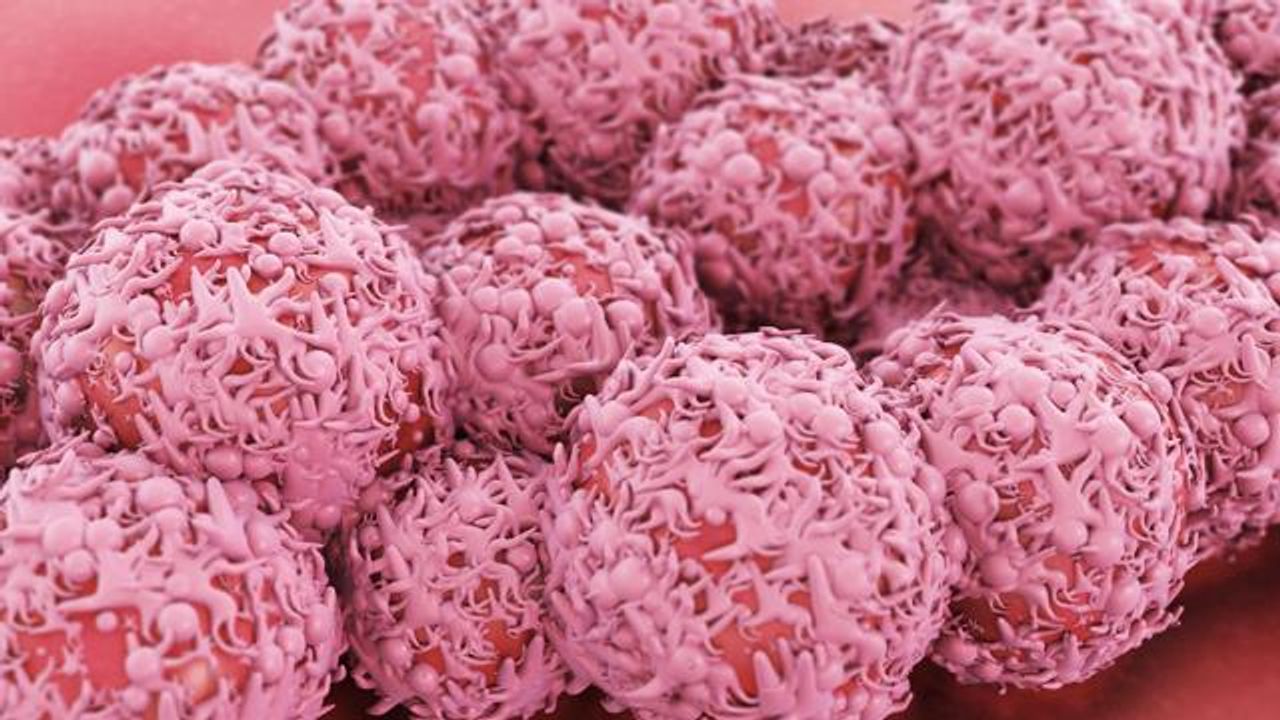 Breast Cancer Organized Into 12 Unique Biological Groups