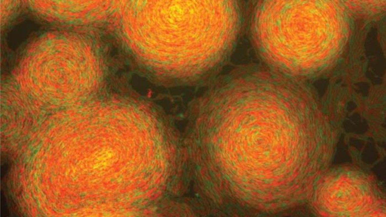 Bacterial "Friend From Foe" Experiment Produces Van Gogh-Like Results