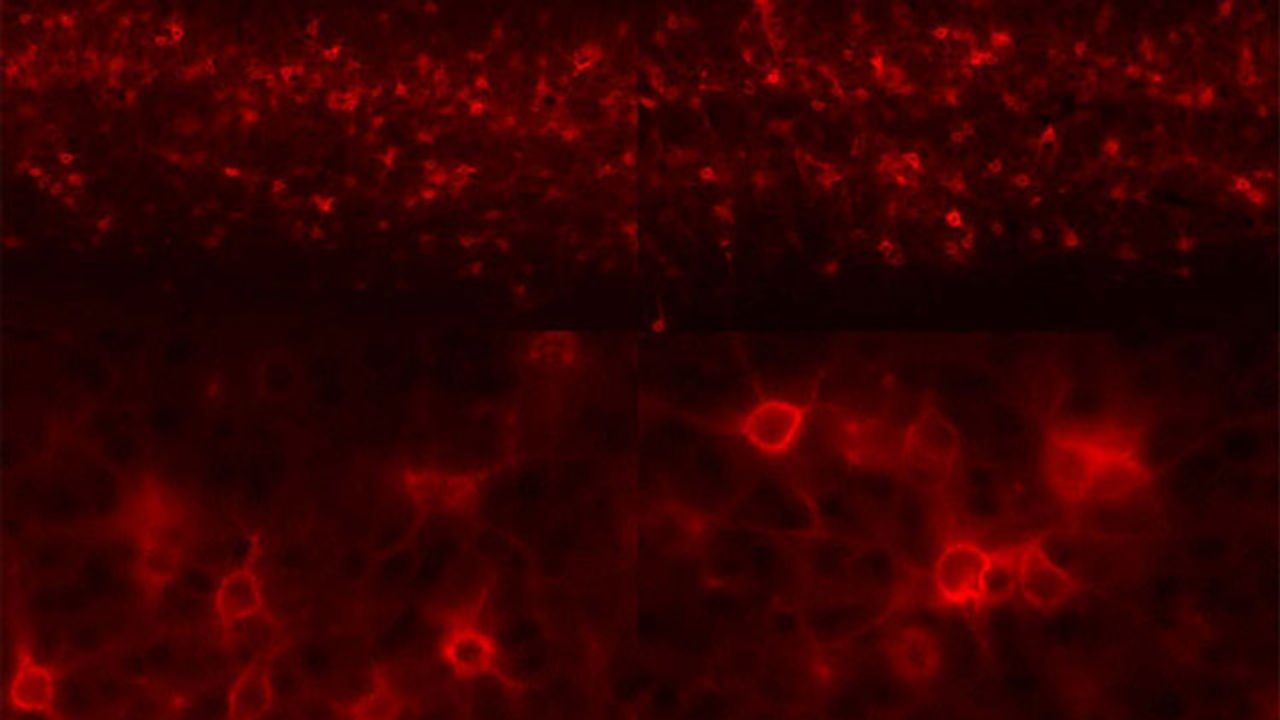 Why Neuronal Plasticity Can Protect the Brain