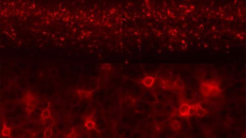 Why Neuronal Plasticity Can Protect the Brain