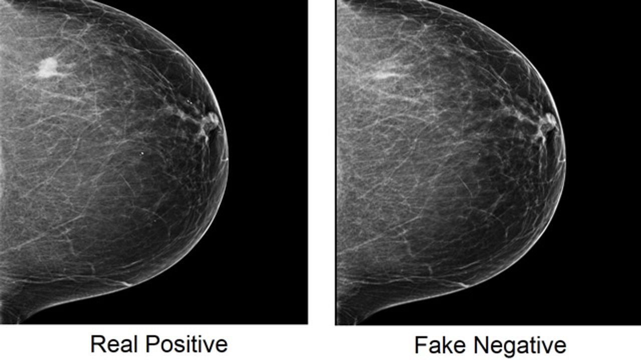 Cancer-Spotting AI Is Vulnerable To Cyberattacks