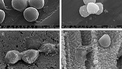 Bacteria Eliminated in 2 Minutes by Modified Copper Surface