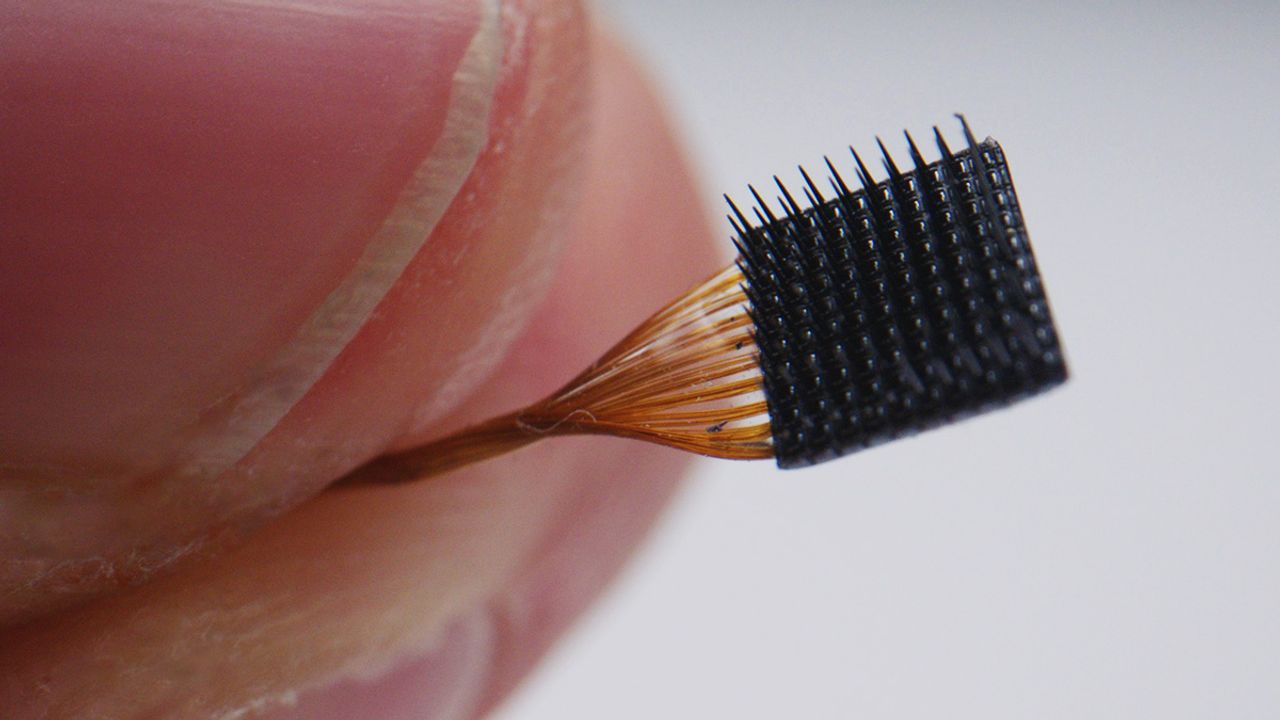 How Could a “Breakthrough” Brain-Computer Interface Help Patients?