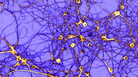 Molecular Switch Could Determine How the Brain Responds to Addictive Drugs