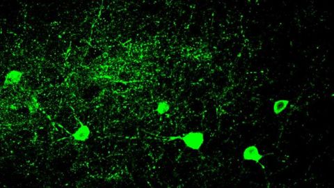 Two Blood Markers of Schizophrenia Identified