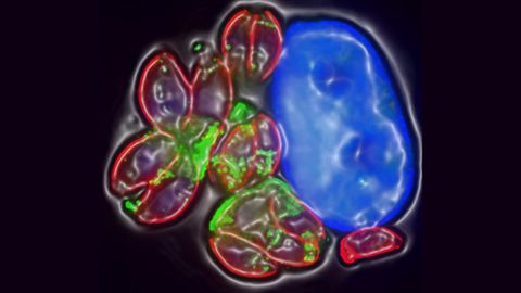 <i>Toxoplasma</i> Parasites Manipulate Brain Cells To Survive
