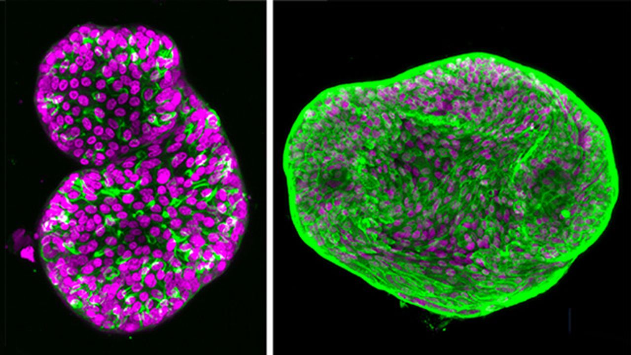 Prostate Cancer Organoids