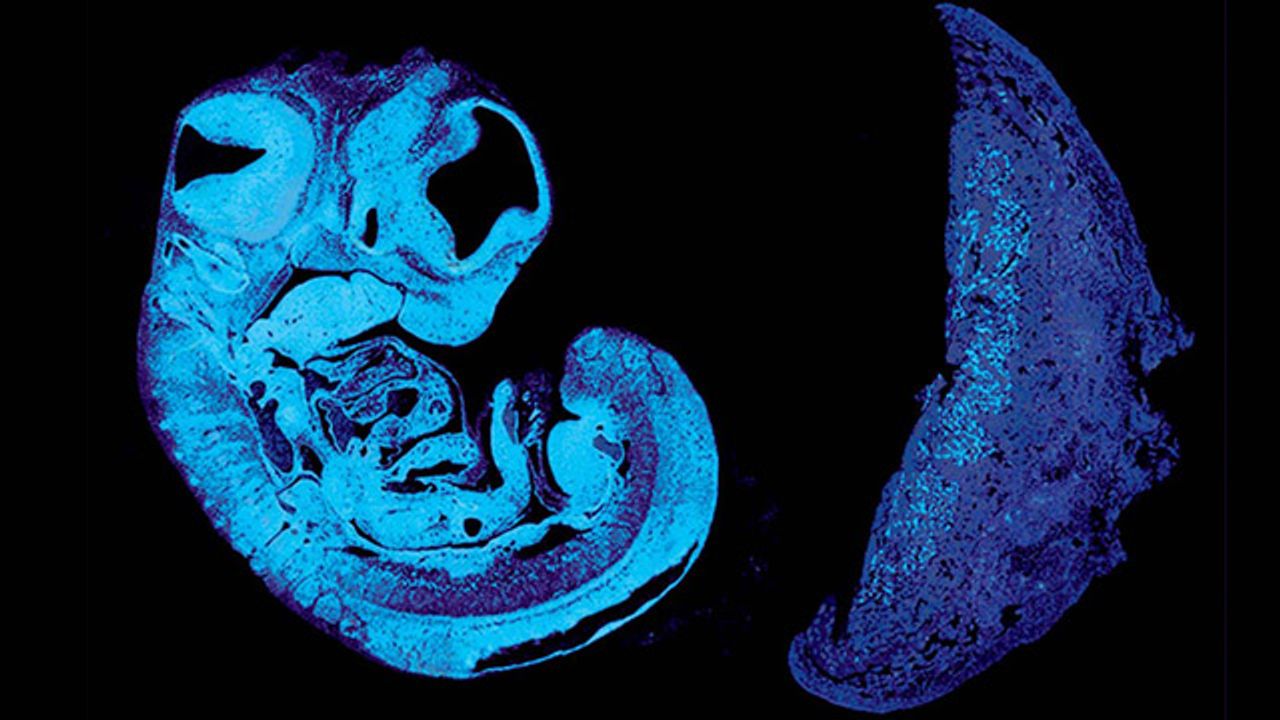 Tug-of-War Between Maternal and Paternal Genes