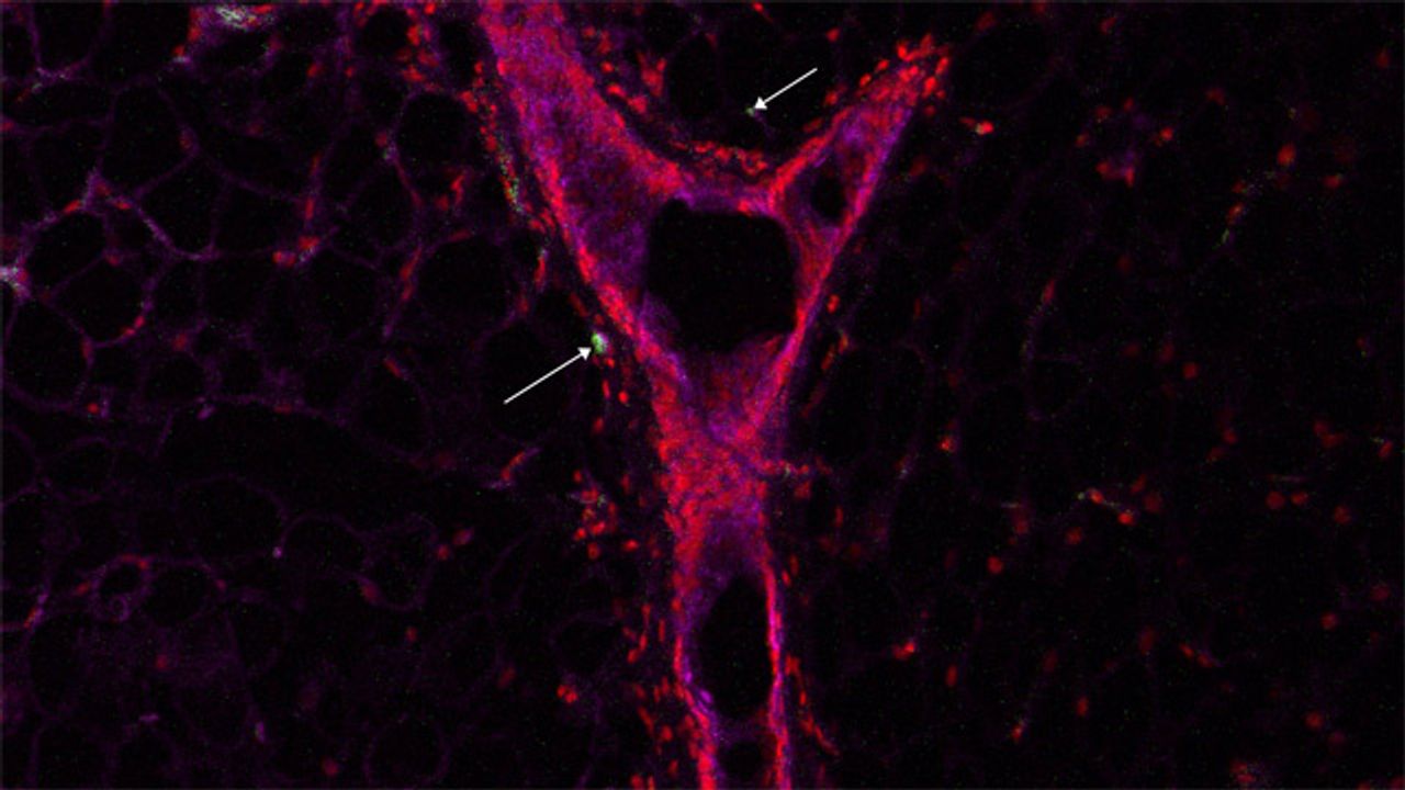 Breast Epithelial Cells