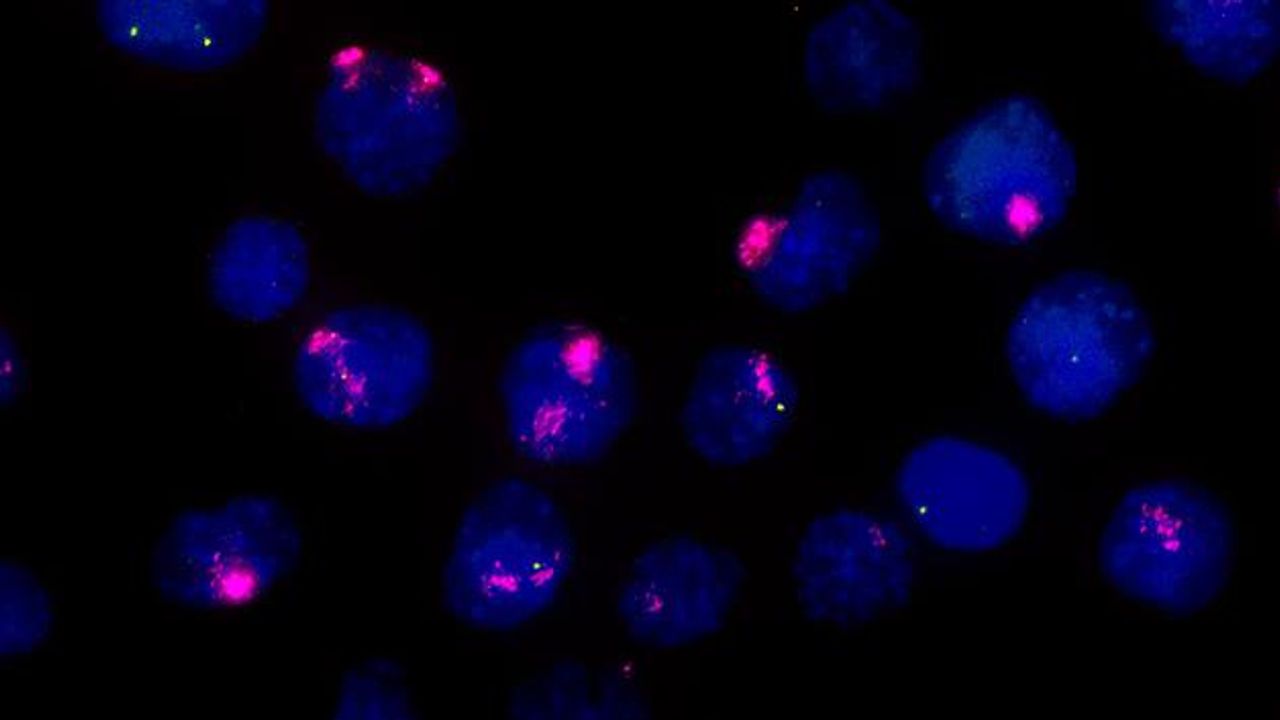 How Cells “Count” Their Chromosomes