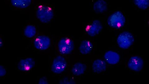 How Cells “Count” Their Chromosomes