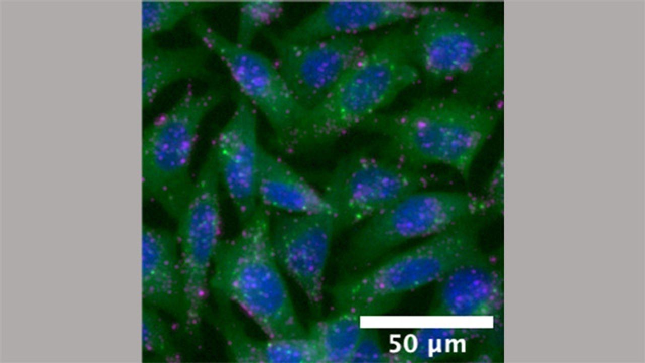 Color-Coded Test Reveals If Nanoparticles Deliver Their Payload