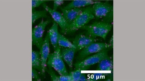 Color-Coded Test Reveals If Nanoparticles Deliver Their Payload