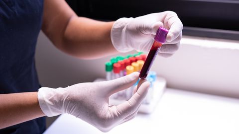 New Test Can Identify Cancer in Patients With Non-Specific Symptoms