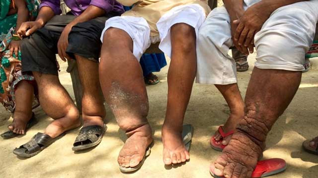 First-in-Human Trial for New Drug Targeting Two Neglected Tropical Diseases