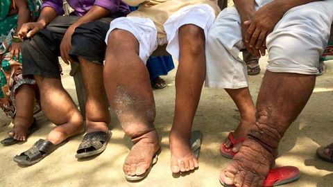 First-in-Human Trial for New Drug Targeting Two Neglected Tropical Diseases