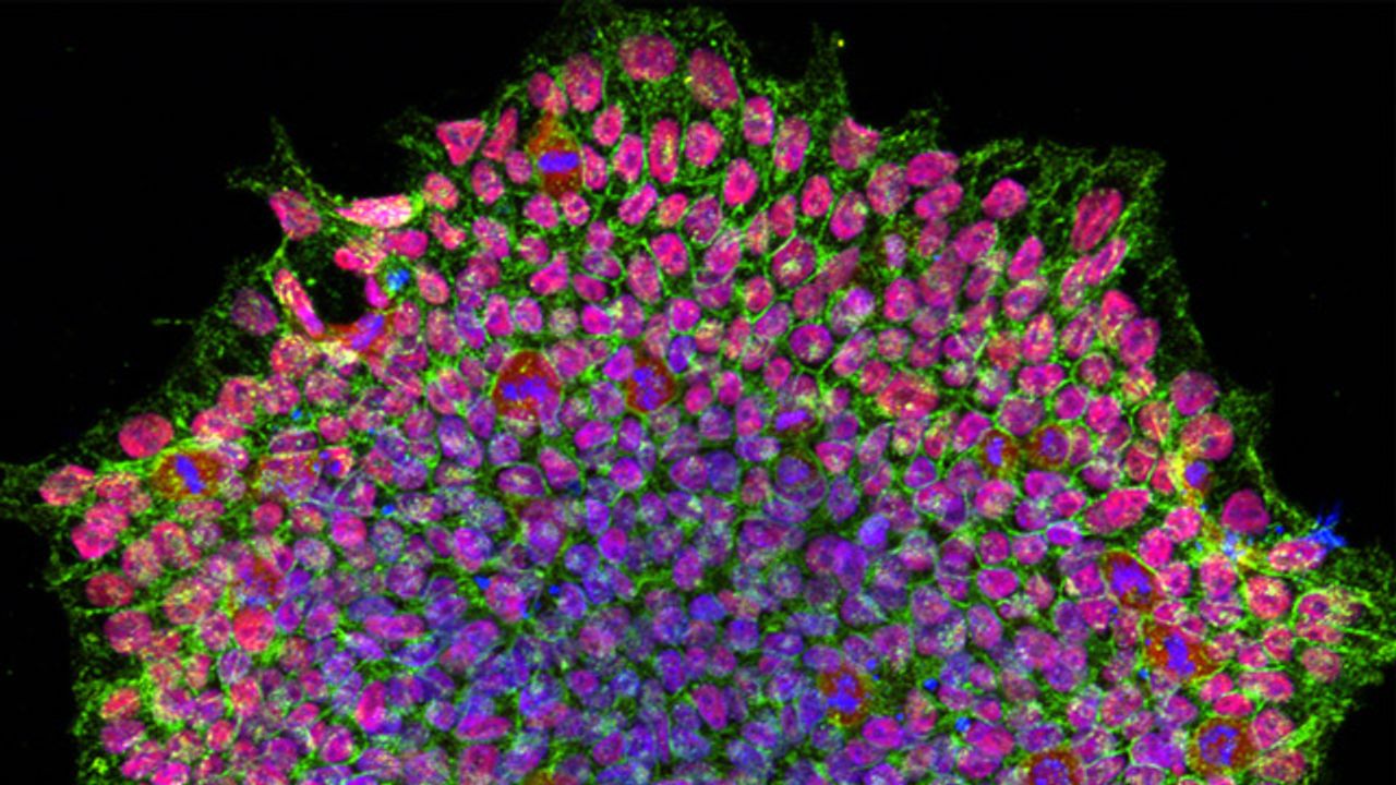 First Stem Cell Model of Albinism Developed
