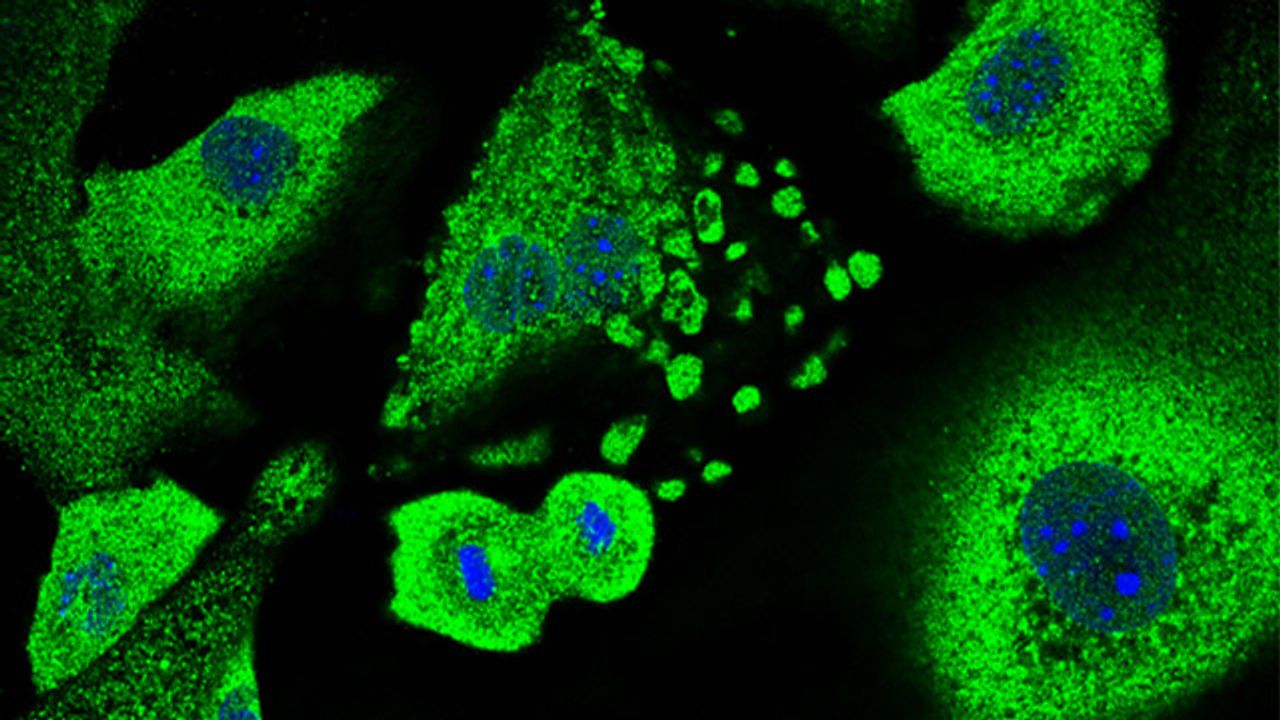 How Skin Cells Form a First Line of Defense Against Cancer