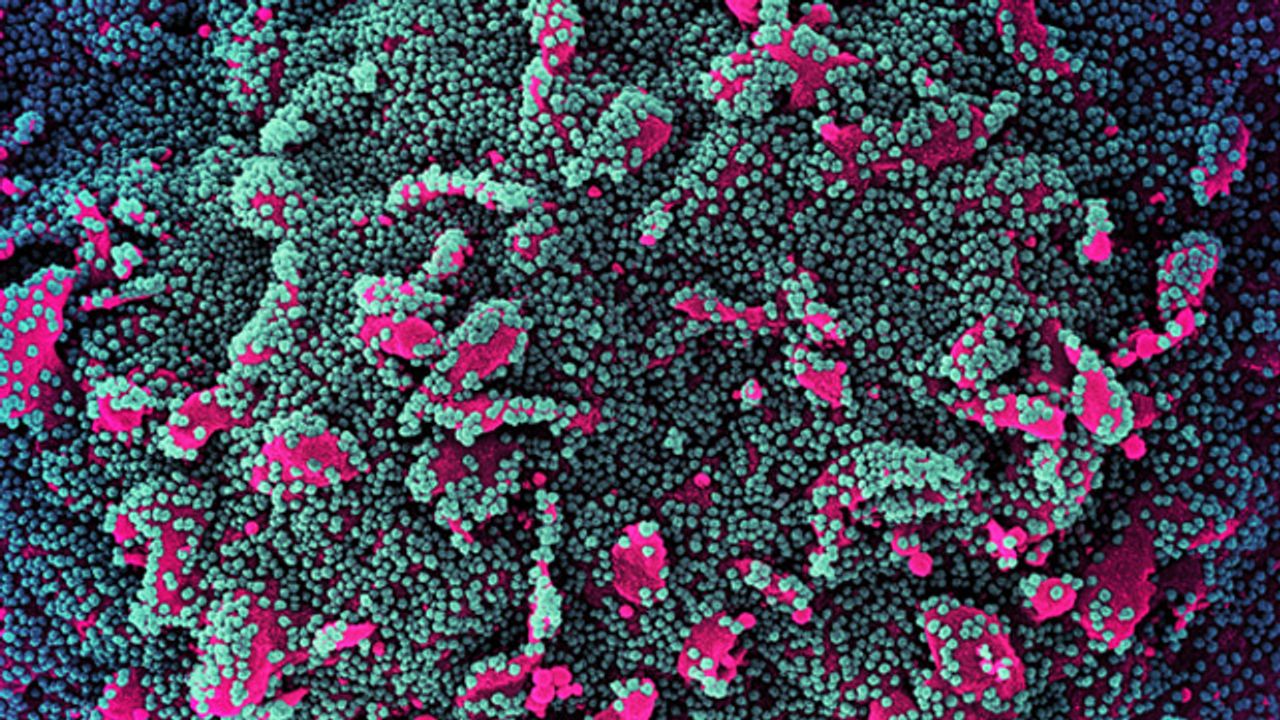 SARS-CoV-2 Infection of a Human Cell