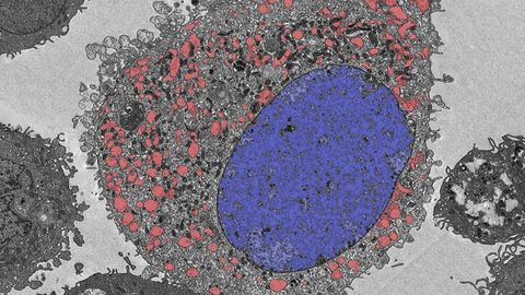 Previously Unrecognized Cell Death Pathway Identified