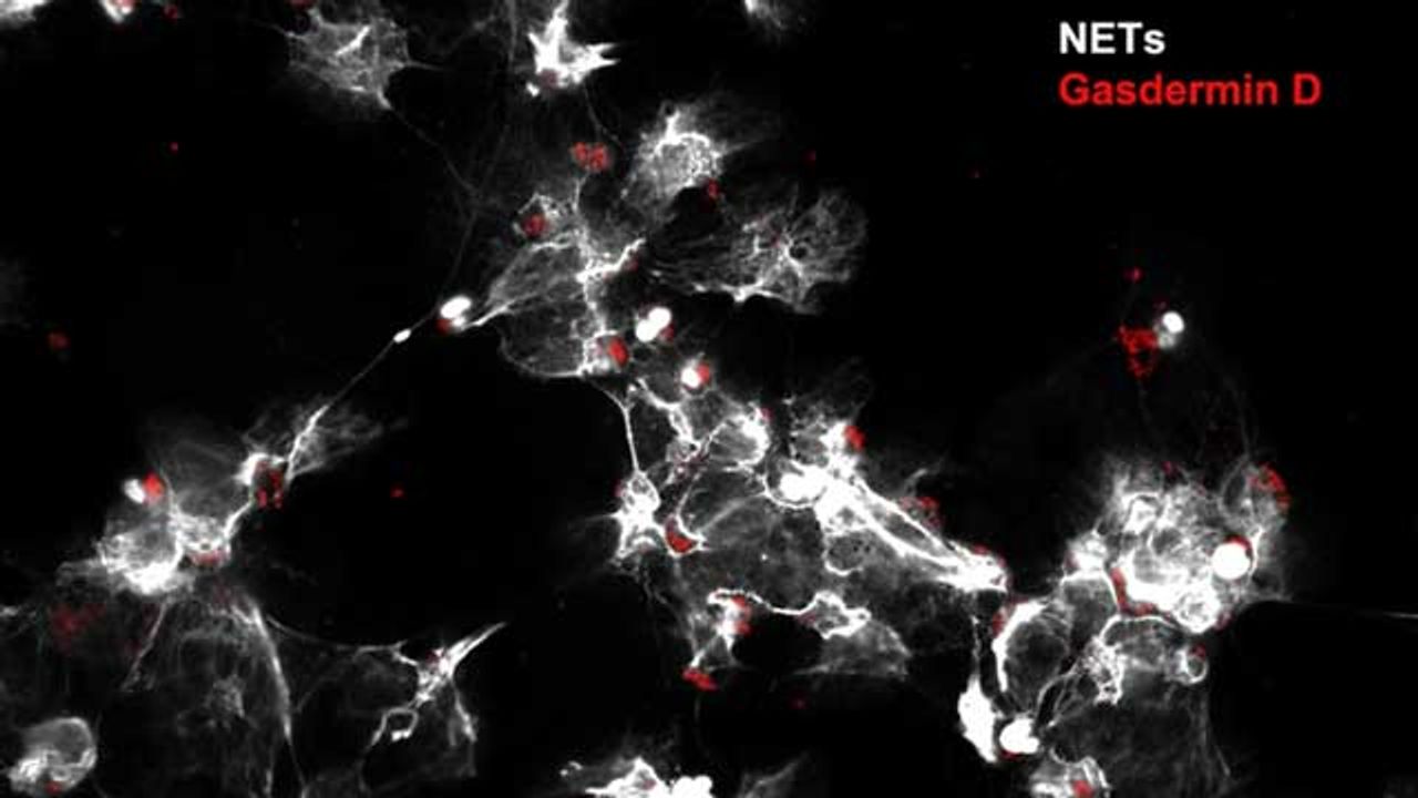 A Novel Therapeutic Strategy To Treat Sepsis