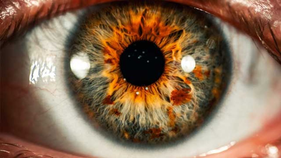 Up to 30% of Patients With Wet Macular Degeneration Could Safely Stop Injections After 1 Year content piece image