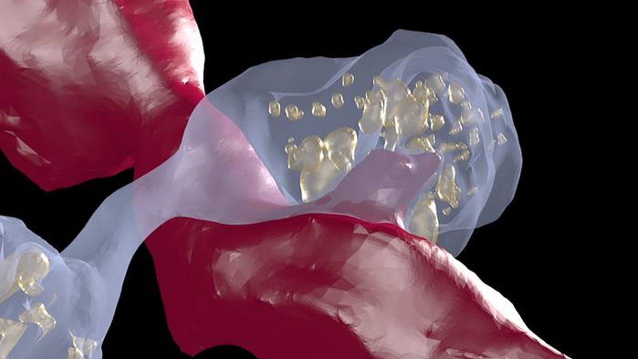 Connectomics Reveals Role of Dopamine in Cocaine Addiction
