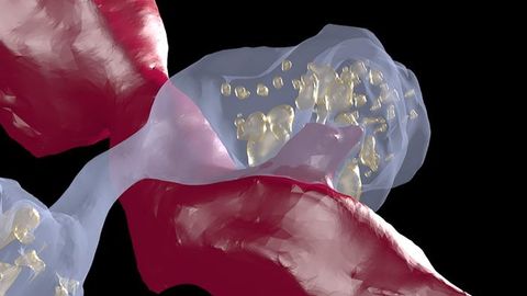 Connectomics Reveals Role of Dopamine in Cocaine Addiction