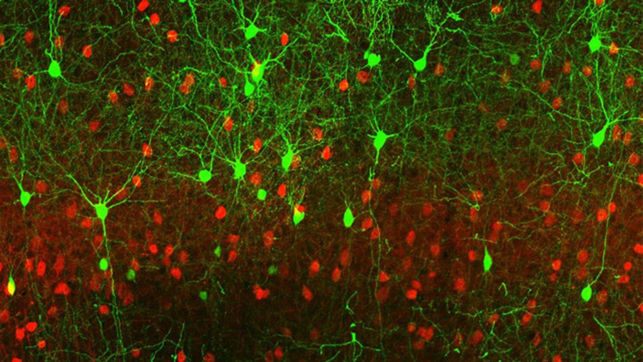Nerve Cells