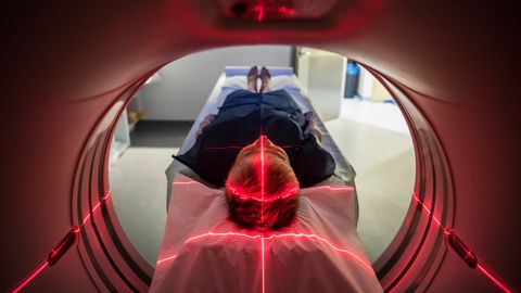 New MRI Technique Could Diagnose Multiple Sclerosis Earlier