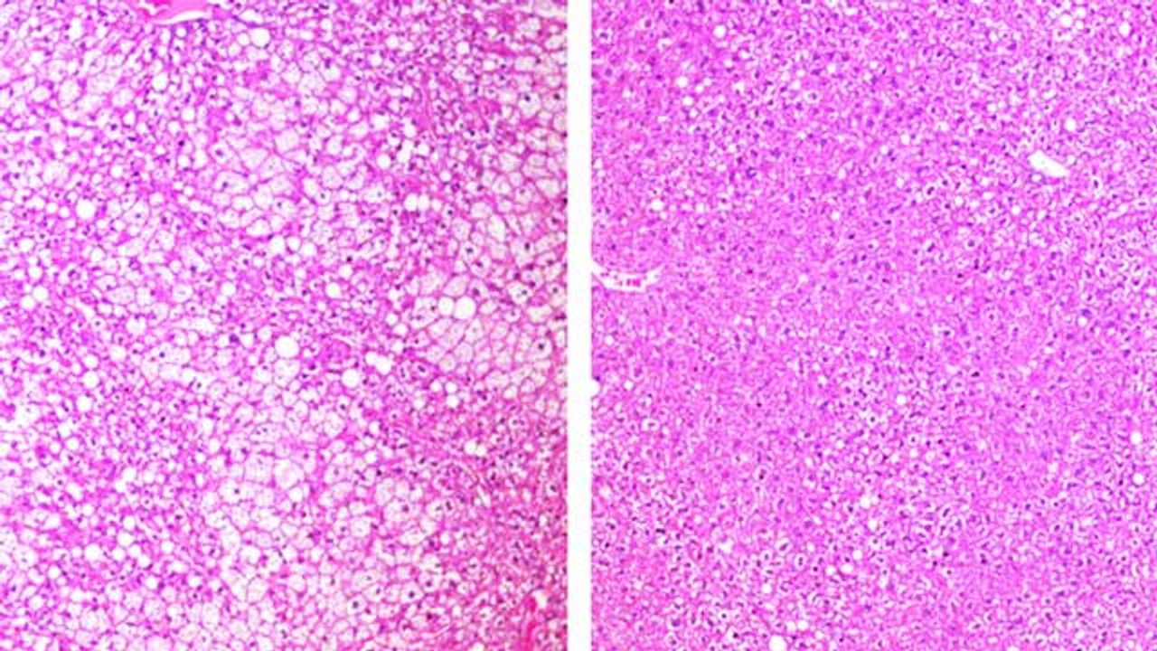 Drug Improves Metabolism and Promotes Weight Loss in Mice