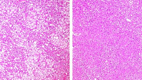Drug Improves Metabolism and Promotes Weight Loss in Mice