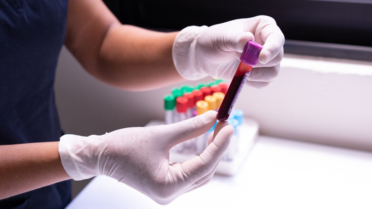Metabolomics-Based Blood Test Could Enable Earlier Detection of Cancer