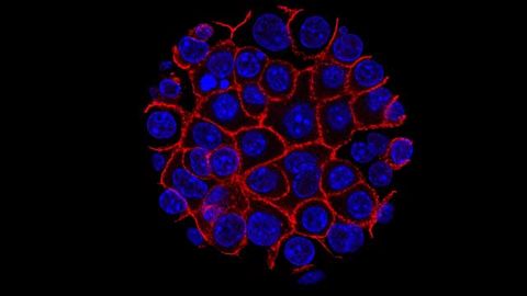 Targeting Healthy Cells Changes Invasive Behavior of Pancreatic Cancer