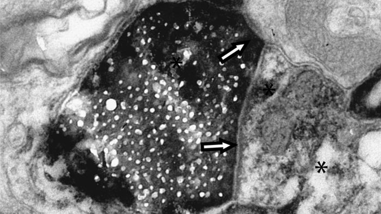 Entirely New Method of Cell-to-Cell Communication Found in the Brain