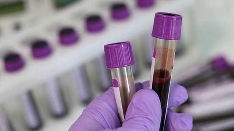 Blood Test, Combined With MRI, Reduces Harm and Costs When Diagnosing Cancer