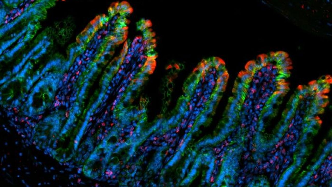 Gut Protected Against Inflammatory Bowel Disease by Protein From Rare Immune Cell