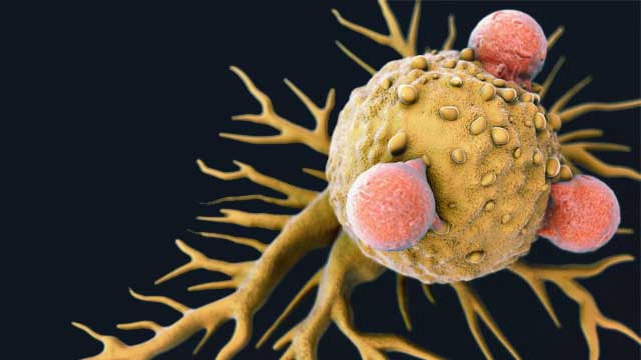 Lactic Acid Impairs the Immune System’s Ability To Kill Cancer Cells